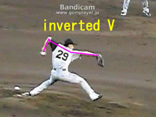 yagi tomoya　inverted v.jpg